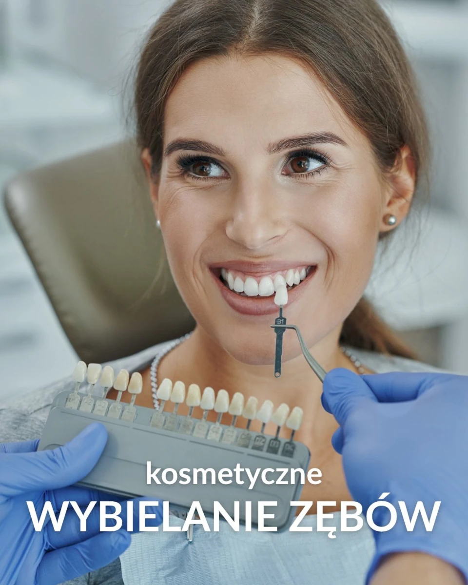 kosmetyczne-wybielanie-zebow-cosmobelle-kosmetologia-medycyna-estetyczna-katowice